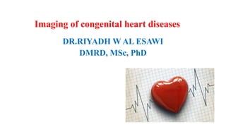 Imaging of congenital heart diseases
DR.RIYADH W AL ESAWI
DMRD, MSc, PhD
 