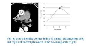 Test-bolus to determine correct timing of contrast enhancement (left)
and region of interest placement in the ascending aorta (right).
 