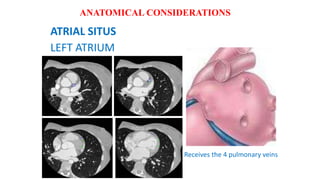ATRIAL SITUS
LEFT ATRIUM
Receives the 4 pulmonary veins
ANATOMICAL CONSIDERATIONS
 
