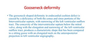 Gooseneck deformity
• The gooseneck-shaped deformity in endocardial cushion defect is
caused by a deficiency of both the conus and sinus portions of the
Interventricular septum, with narrowing of the left ventricular outflow
tract. The concavity of the interventricular septum below the mitral
valve, along with the elongation and narrowing of the left ventricular
outflow tract, produces a characteristic shape that has been compared
to a sitting goose with an elongated neck on the anteroposterior
projection in left ventricular angiography.
 