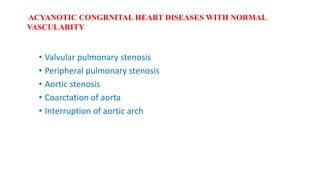 • Valvular pulmonary stenosis
• Peripheral pulmonary stenosis
• Aortic stenosis
• Coarctation of aorta
• Interruption of aortic arch
ACYANOTIC CONGRNITAL HEART DISEASES WITH NORMAL
VASCULARITY
 