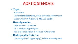 AORTIC STENOSIS
• Types:
Sub-vavular
Valvular (bicuspid valve, single horseshoe-shaped valve)
Supravalvular  Williams $ (MR, AS and PS)
• Hemodynamics:
Obstruction of LV outflow
LV is enlarged (hypertrophy)
Post-stenotic dilatation of Aorta in Valvular type
• Radiographic features:
Cardiomegaly (LV hypertrophy), Dilated ascending aorta
 