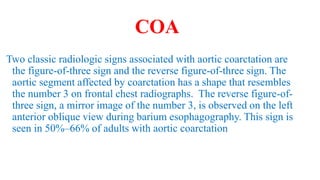 COA
Two classic radiologic signs associated with aortic coarctation are
the figure-of-three sign and the reverse figure-of-three sign. The
aortic segment affected by coarctation has a shape that resembles
the number 3 on frontal chest radiographs. The reverse figure-of-
three sign, a mirror image of the number 3, is observed on the left
anterior oblique view during barium esophagography. This sign is
seen in 50%–66% of adults with aortic coarctation
 
