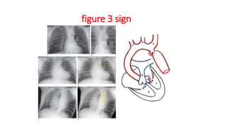 figure 3 sign
 