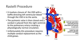 Cyanotic heart diseases | PPTX