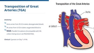 Congenital Heart Diseases v1 gemini.pptx
