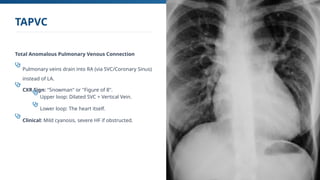 Svc. Sign Congenital Heart Diseases v1 gemini.pptx