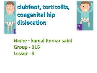 clubfoot, torticollis,
congenital hip
dislocation
Name - kamal Kumar saini
Group - 116
Lesson -3
 