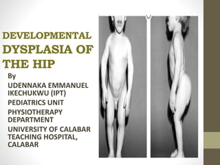 DEVELOPMENTAL
DYSPLASIA OF
THE HIP
By
UDENNAKA EMMANUEL
IKECHUKWU (IPT)
PEDIATRICS UNIT
PHYSIOTHERAPY
DEPARTMENT
UNIVERSITY OF CALABAR
TEACHING HOSPITAL,
CALABAR
 