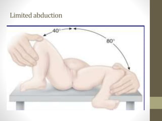 Limitedabduction
 