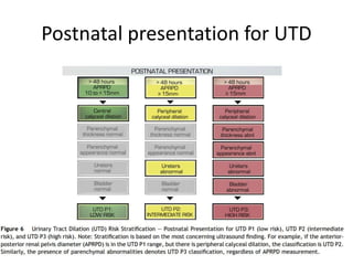 Postnatal presentation for UTD
 