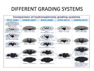 DIFFERENT GRADING SYSTEMS
 