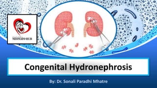 Congenital Hydronephrosis
By: Dr. Sonali Paradhi Mhatre
 