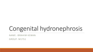 Congenital hydronephrosis
NAME: IBRAHIM KEWAN
GROUP: M1751
 