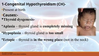 1-Congenital Hypothyroidism (CH)-
•Present at birth
•Causes:-
Thyroid dysgenesis-
•Aplasia – thyroid gland is completely missing
•Hypoplasia – thyroid gland is too small
•Ectopic – thyroid is in the wrong place (not in the neck)
MS. ANEETA SHARMA
NURSING LECTURER (CHILD HEALTH NURSING)
 