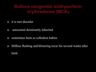 Congenital ichthyosis | PPTX
