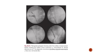 Renal Rotation Radiology Congenital Kidney Anomalies * ANOMALIES OF RENAL NUMBER * ANOMALIES OF ...