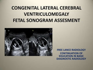 CONGENITAL LATERAL CEREBRAL
     VENTRICULOMEGALY
 FETAL SONOGRAM ASSESMENT




                 FREE LANCE RADIOLOGY
                    CONTINUATION OF
                   EDUCATION IN BASIC
                 DIAGNOSTIC RADIOLOGY
 