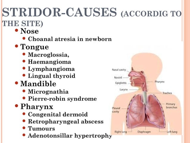 Congenital lesions of larynx and stridor management | PPT