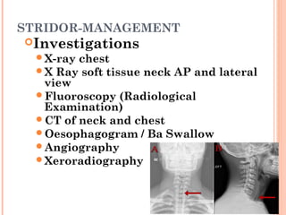 Stridor Scope Congenital lesions of larynx and stridor management | PPT
