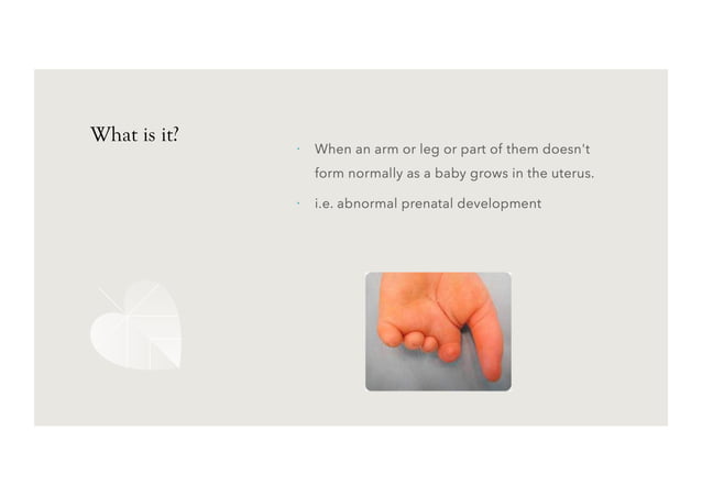 Congenital Limb deficiencies. Physiotherapy for pediatrics.pdf | Death ...