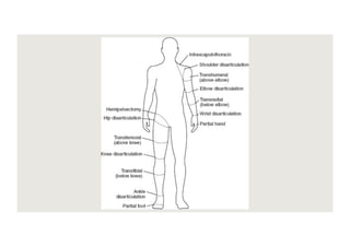 Congenital Limb deficiencies. Physiotherapy for pediatrics.pdf