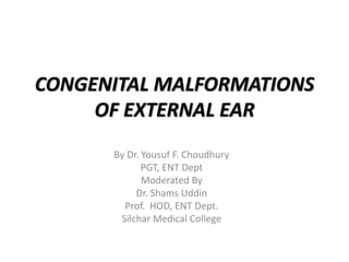 CONGENITAL MALFORMATIONS
OF EXTERNAL EAR
By Dr. Yousuf F. Choudhury
PGT, ENT Dept
Moderated By
Dr. Shams Uddin
Prof. HOD, ENT Dept.
Silchar Medical College
 
