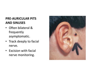 Congenital malformation of external ear and it’s management | PPTX