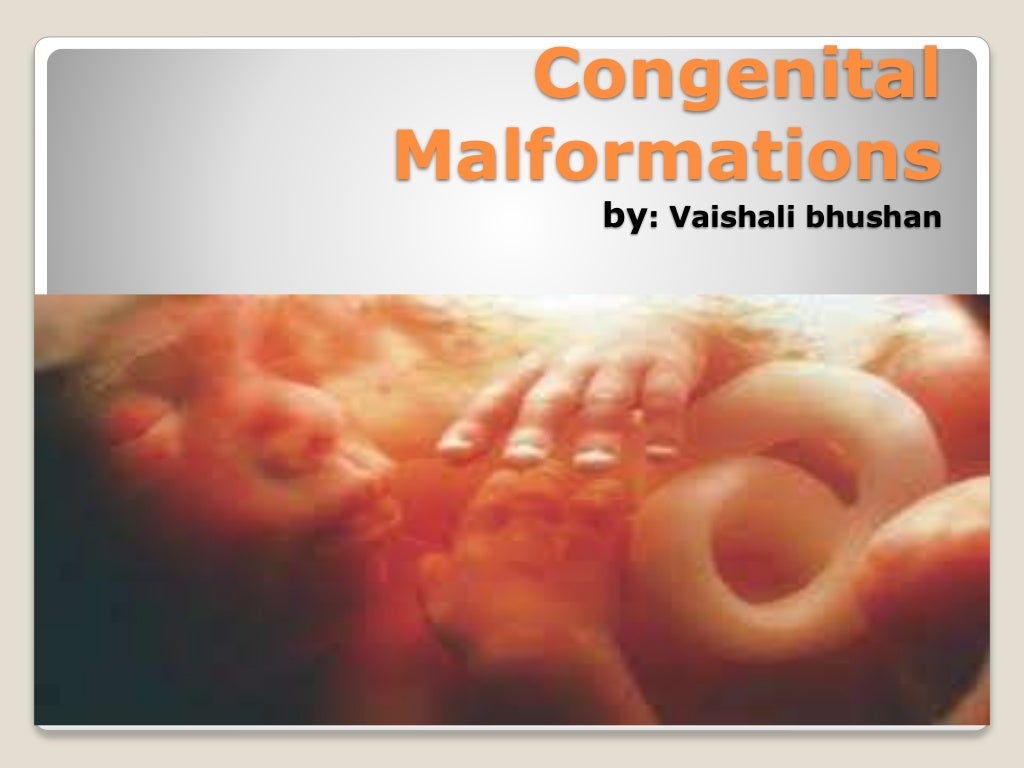 Congenital Malformations