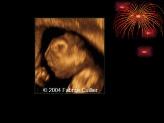 CONGENITAL MALFORMATIONS gogo.ppt cfmf   n