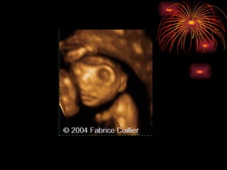 CONGENITAL MALFORMATIONS gogo.ppt cfmf   n