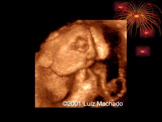 CONGENITAL MALFORMATIONS gogo.ppt cfmf   n
