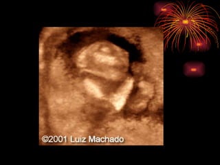 CONGENITAL MALFORMATIONS gogo.ppt cfmf   n