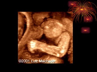CONGENITAL MALFORMATIONS gogo.ppt cfmf   n