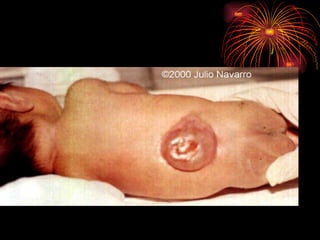 CONGENITAL MALFORMATIONS gogo.ppt cfmf   n
