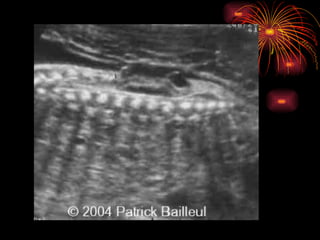 CONGENITAL MALFORMATIONS gogo.ppt cfmf   n