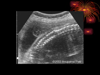 CONGENITAL MALFORMATIONS gogo.ppt cfmf   n