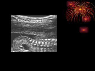 CONGENITAL MALFORMATIONS gogo.ppt cfmf   n