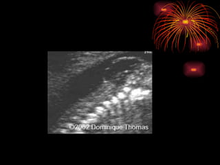 CONGENITAL MALFORMATIONS gogo.ppt cfmf   n