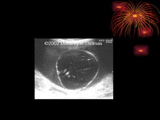 CONGENITAL MALFORMATIONS gogo.ppt cfmf   n
