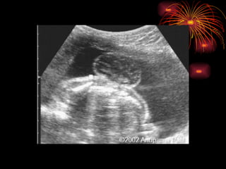 CONGENITAL MALFORMATIONS gogo.ppt cfmf   n