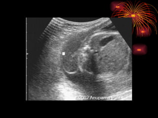CONGENITAL MALFORMATIONS gogo.ppt cfmf   n