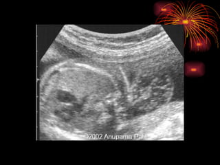 CONGENITAL MALFORMATIONS gogo.ppt cfmf   n