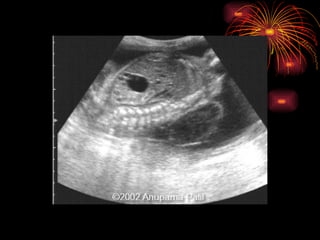 CONGENITAL MALFORMATIONS gogo.ppt cfmf   n