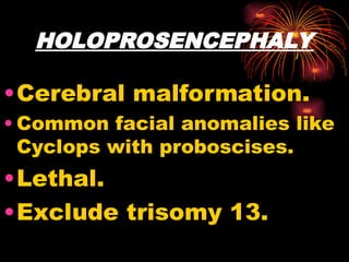 HOLOPROSENCEPHALY
•Cerebral malformation.
• Common facial anomalies like
Cyclops with proboscises.
•Lethal.
•Exclude trisomy 13.
 