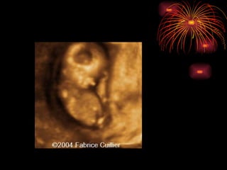 CONGENITAL MALFORMATIONS gogo.ppt cfmf   n