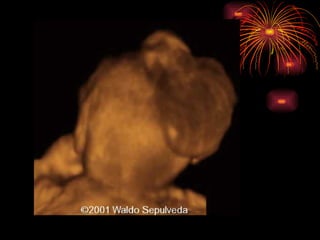 CONGENITAL MALFORMATIONS gogo.ppt cfmf   n