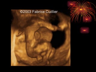 CONGENITAL MALFORMATIONS gogo.ppt cfmf   n