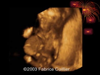 CONGENITAL MALFORMATIONS gogo.ppt cfmf   n