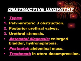 OBSTRUCTIVE UROPATHY
• Types:
1. Pelvi-ureteric J obstruction.
2. Posterior urethral valves.
3. Urethral stenosis.
• Antenatal diagnosis: enlarged
bladder, hydronephrosis.
• Postnatal: abdominal mass.
• Treatment: in utero decompression.
 